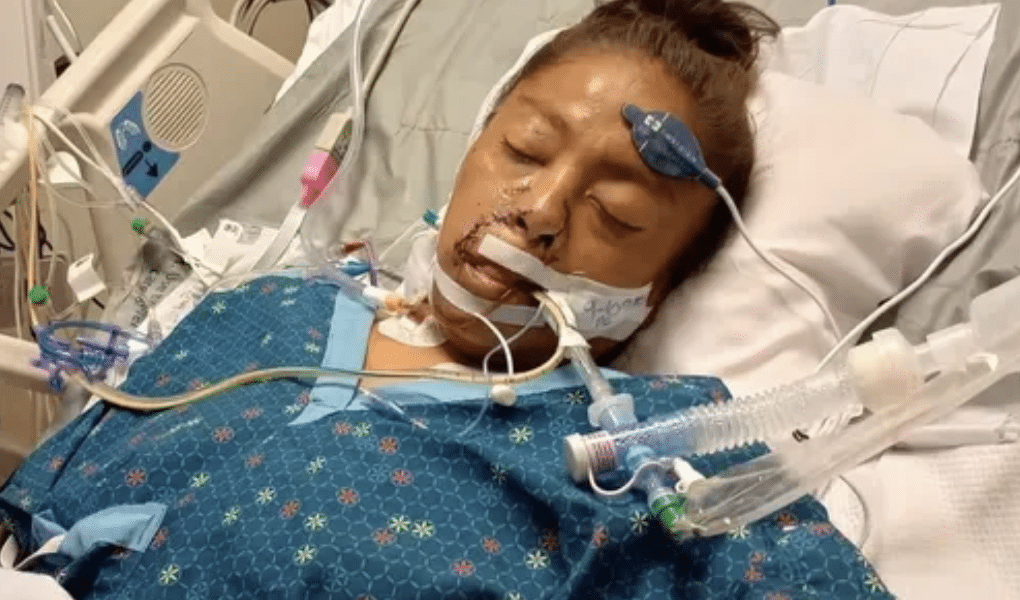 Pitbull-Angriff in Oklahoma