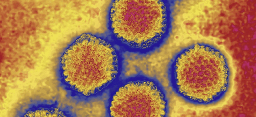 Hepatitis A in Skirort in Tschechien